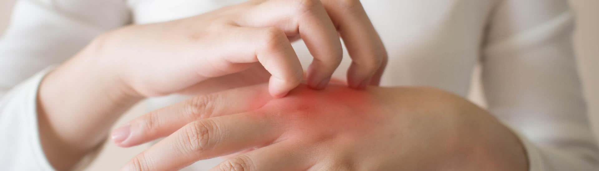 Hand Dermatitis: What’s it to YOU? 